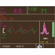 Monitor de gasto cardiaco no invasivo Casmed Lifegard ICG