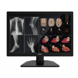 Pantalla monitor radiodiagnóstico 30" 6MP grado médico C630G